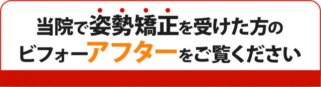 当院で姿勢矯正を受けた方のビフォーアフターをご覧ください